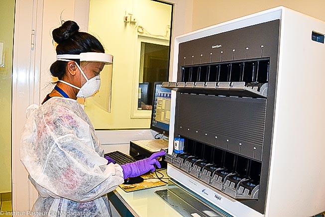 GeneXpert®: un outil particulièrement adapté à la prise en charge hospitalière des cas de COVID-19 et à la gestion et au suivi de cette épidémie dans les pays du Sud.
