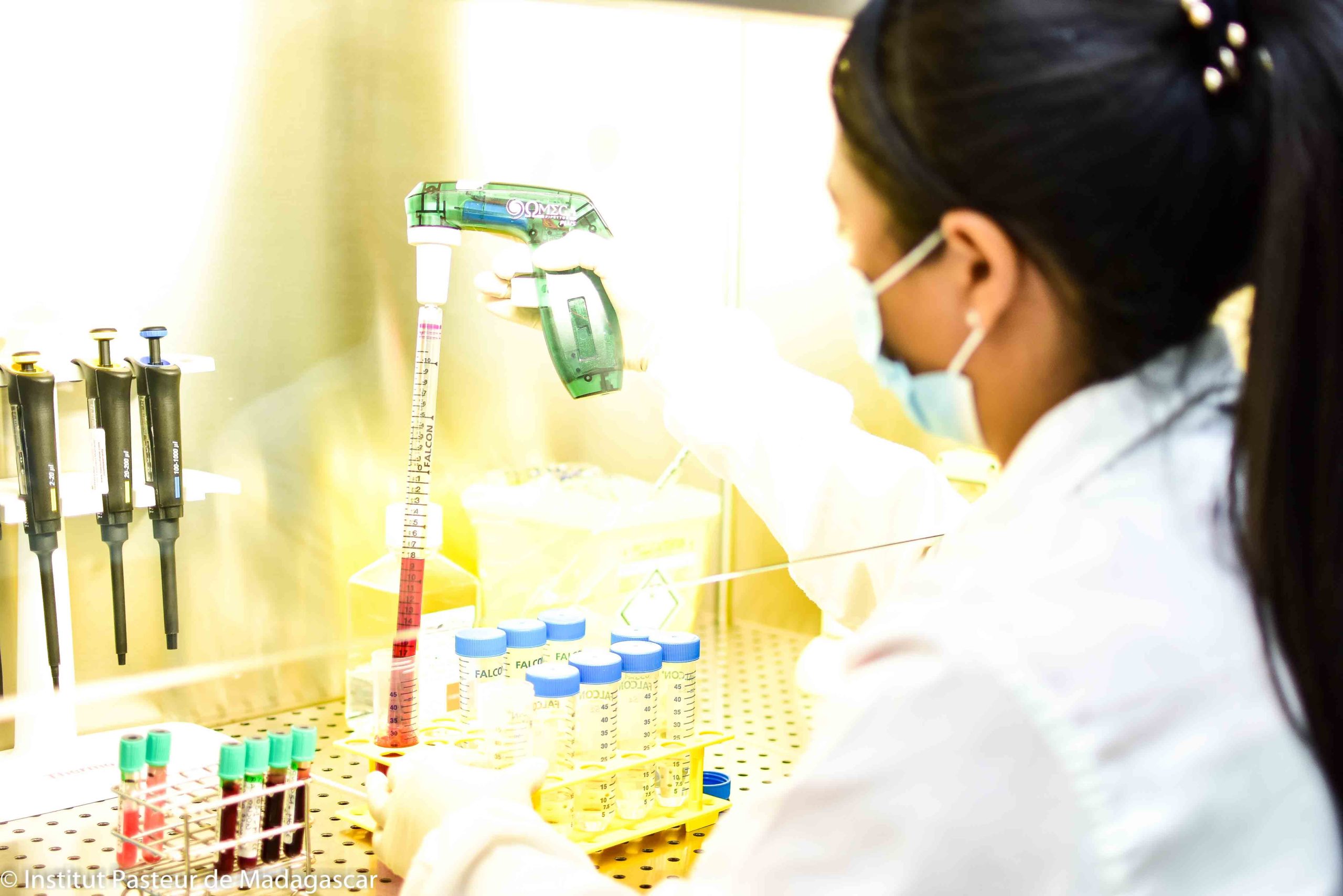 Séroprévalence d’anticorps Anti-SARS-CoV-2 chez les donneurs de Sang à Madagascar durant l’épidémie de 2020