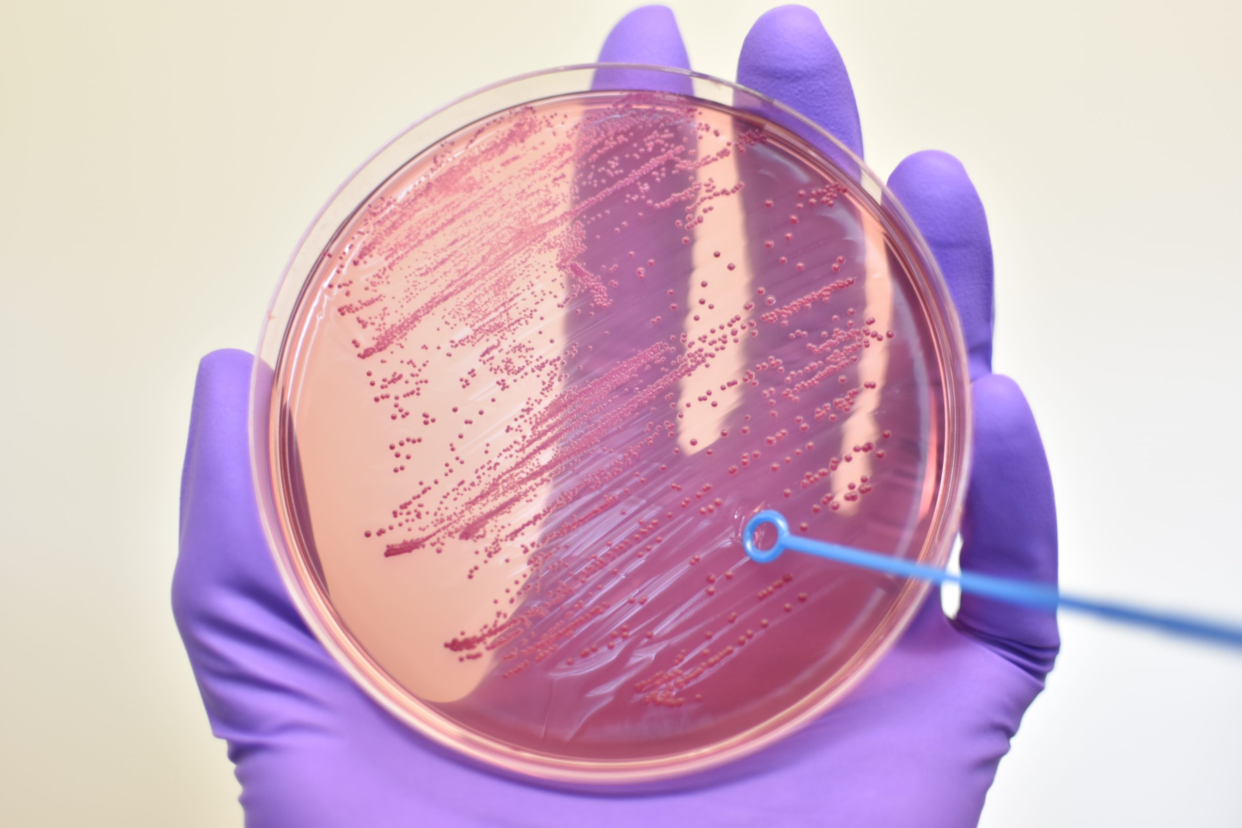 International course on plague : laboratory diagnosis and surveillance